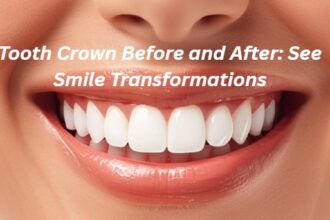 Tooth Crown Before and After: See Smile Transformations